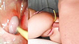 Amazing anal. Camera in Her Ass Deep Anal Fuck and Internal Creampie